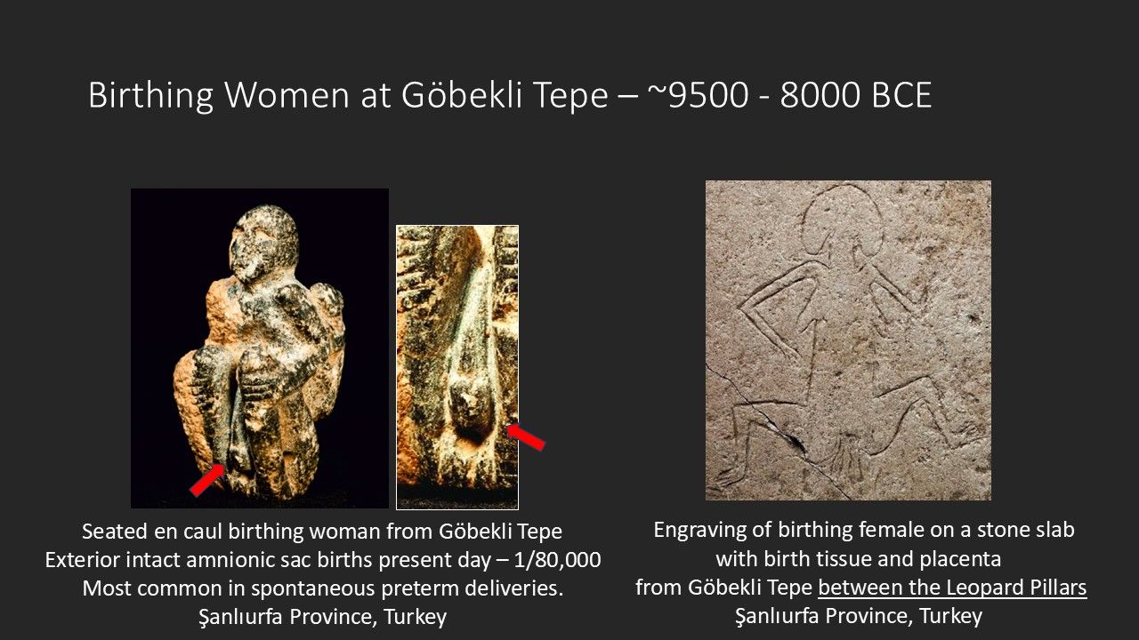 Göbeklitepe — Şanlıurfa Web Tasarım